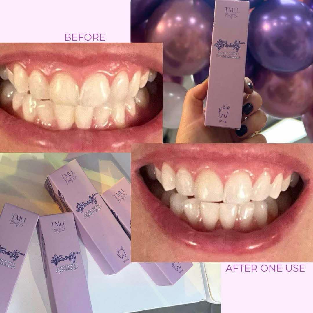 TMLL Tooth Brightening Kit